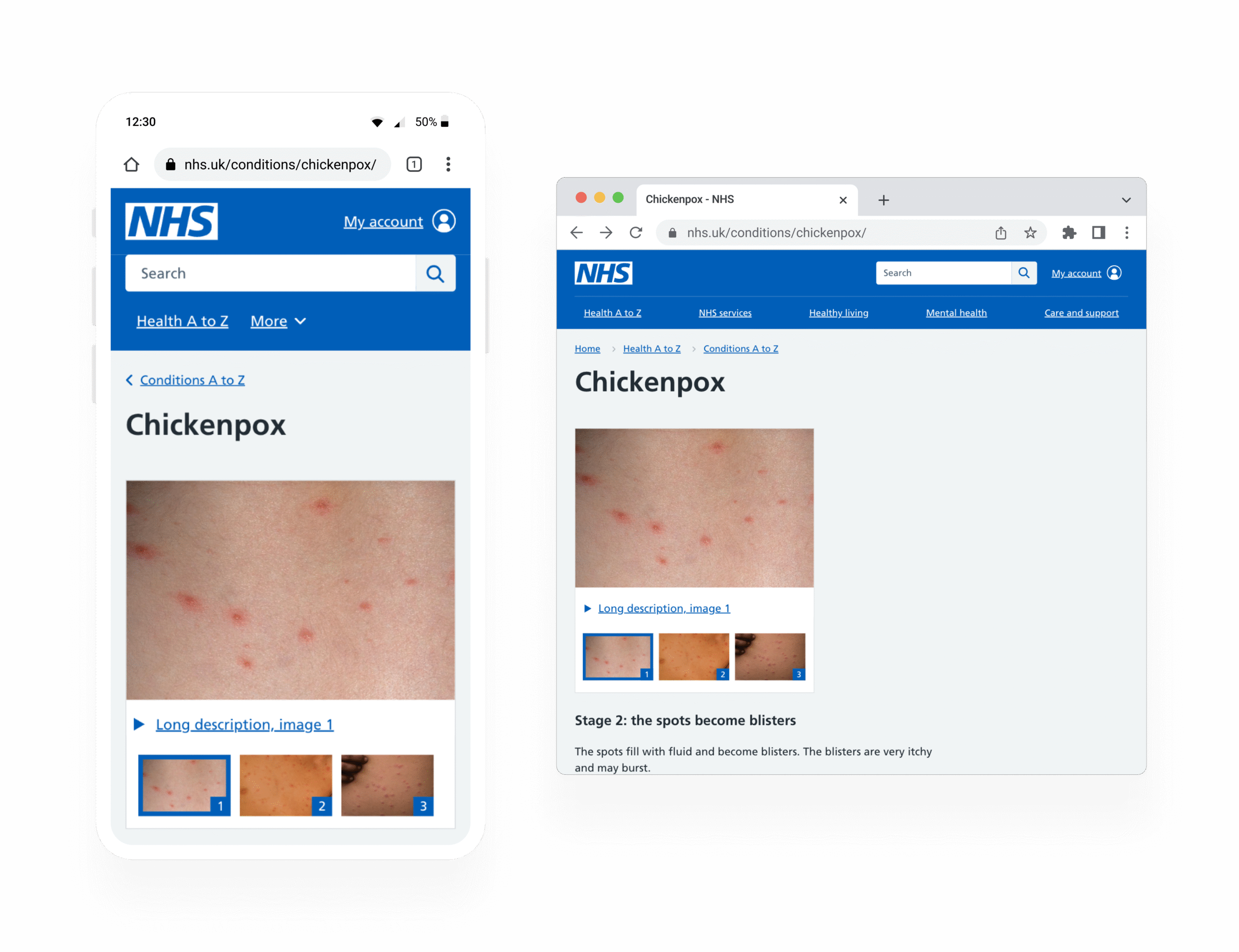 Screens showing the component in mobile and desktop viewports on the live NHS website